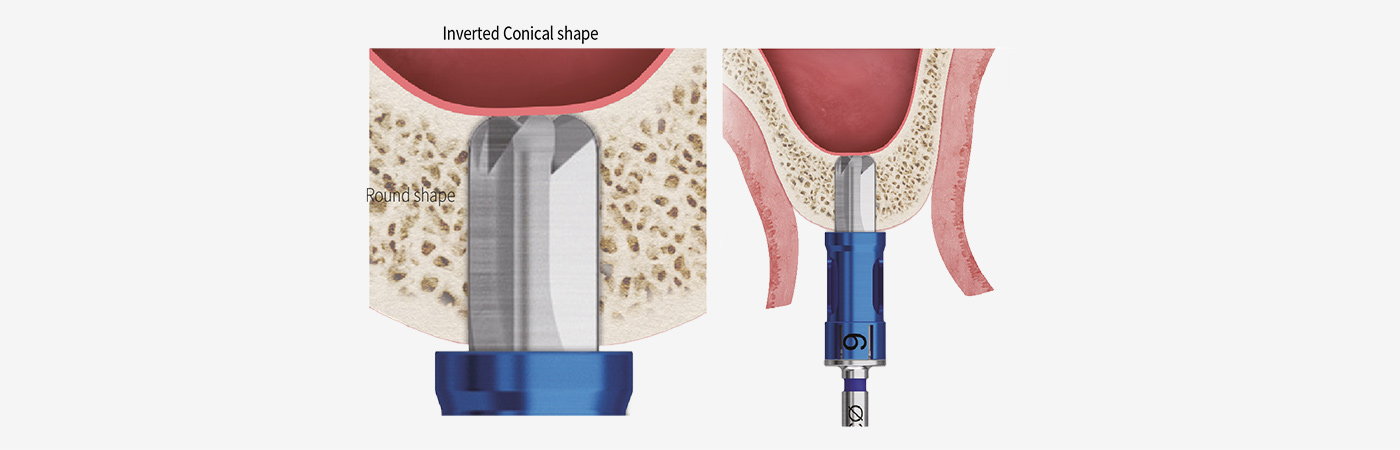 Illustration of the CAS round-tip drill and inverted conical cutting form near the maxillary sinus floor