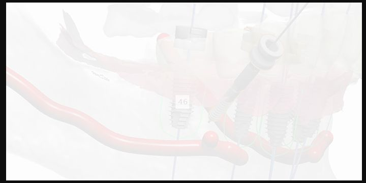解剖感知规划