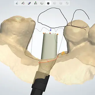 Dental implant engineering and technical design