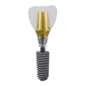 Focused implant engineering and clinical knowledge.