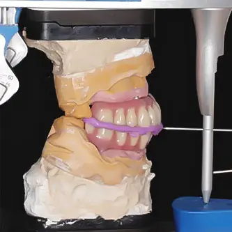 Laboratory model used to record an implant impression relationship